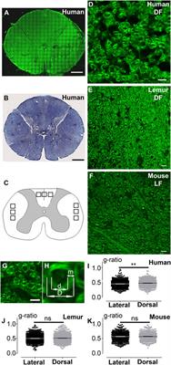 Coherent Anti-Stokes Raman Scattering Microscopy: A Label-Free Method to Compare Spinal Cord Myelin in Different Species